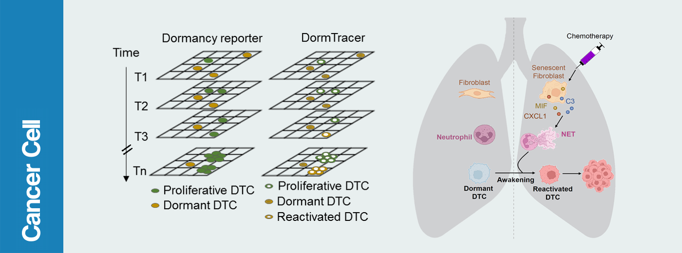 Chinese Scientists Develop a Metastatic Dormancy Lineage Tracing System and Reveal the Effect of Chemotherapy on Dormancy Awakening